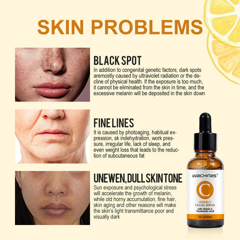 Vitamin C Serum for Face Vitamin E & Hyaluronic Acid Boost Collagen