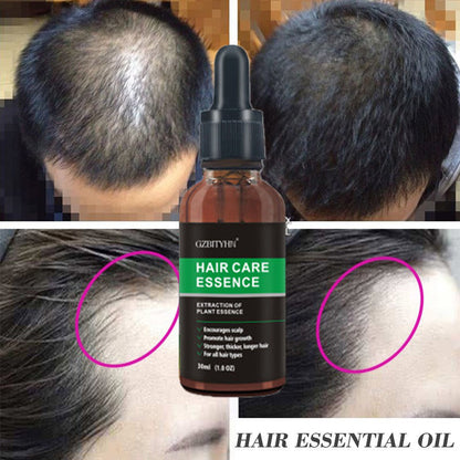 Hair Growth Serum Essence  Hair Growth Oil - Thinning & Loss Treatment