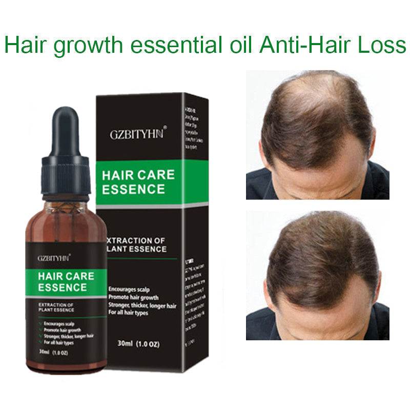 Hair Growth Serum Essence  Hair Growth Oil - Thinning & Loss Treatment