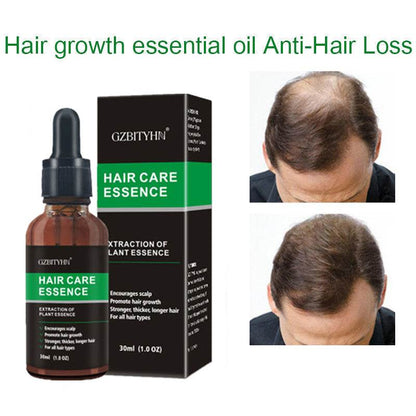 Hair Growth Serum Essence  Hair Growth Oil - Thinning & Loss Treatment