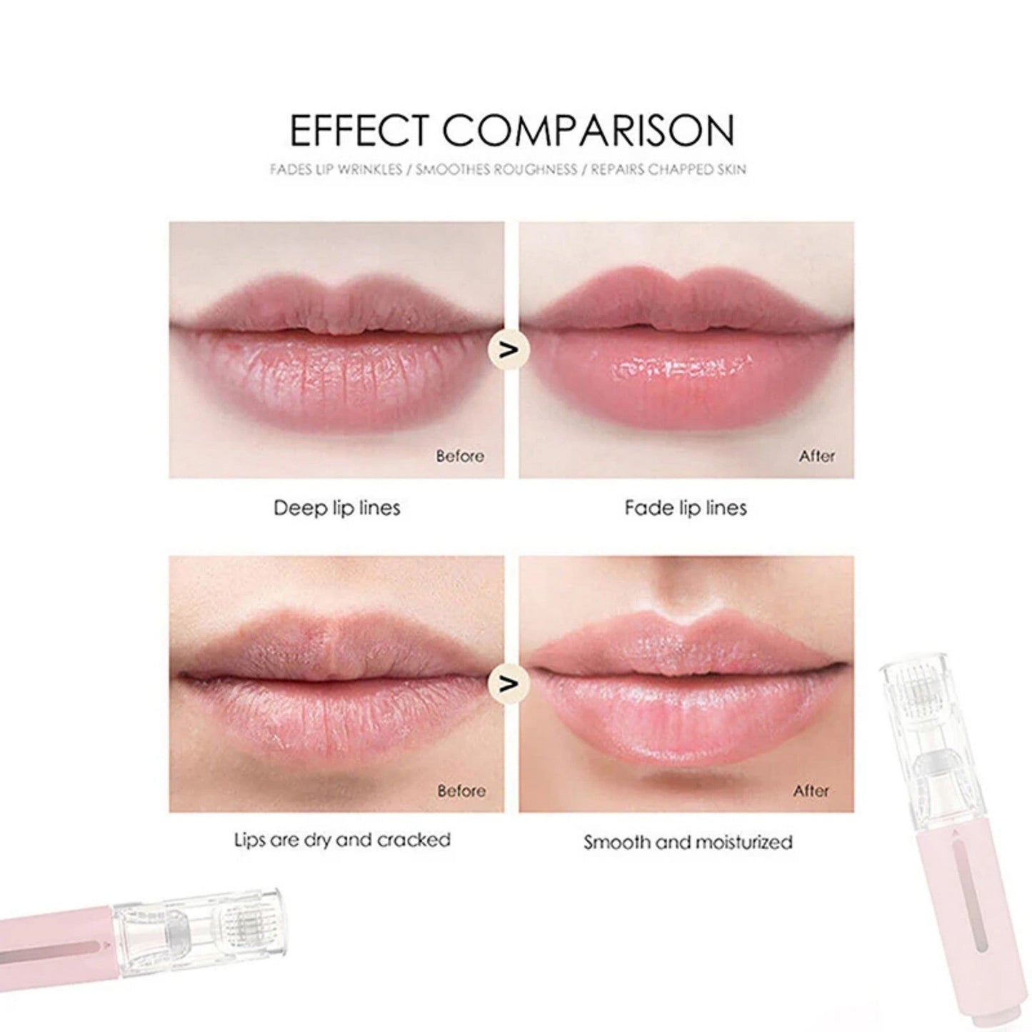 Lip Care Boost Micro Derma for Lips Moisturizing with Serum Applicator