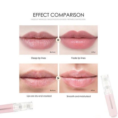 Lip Care Boost Micro Derma for Lips Moisturizing with Serum Applicator